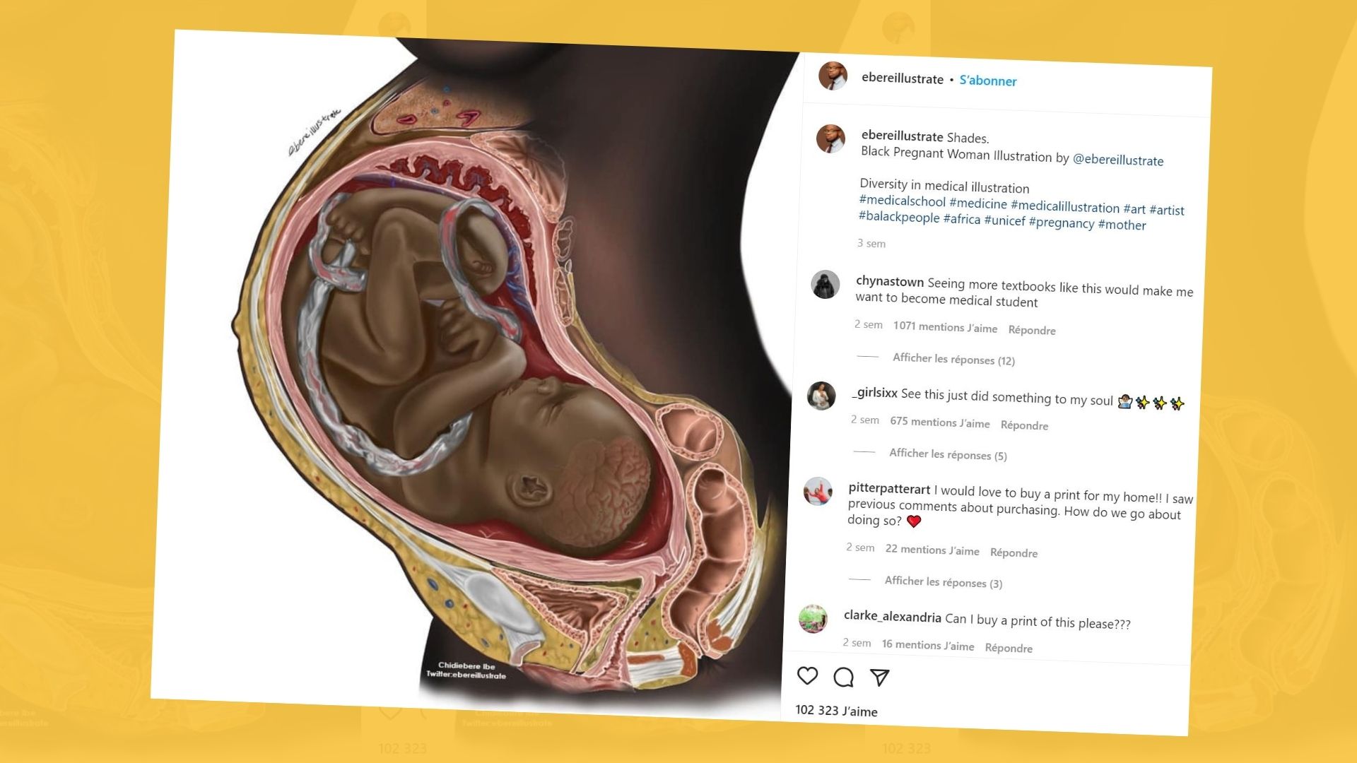 Une femme noire enceinte dans un manuel médical, ça reste si rare que ça fait le tour du monde