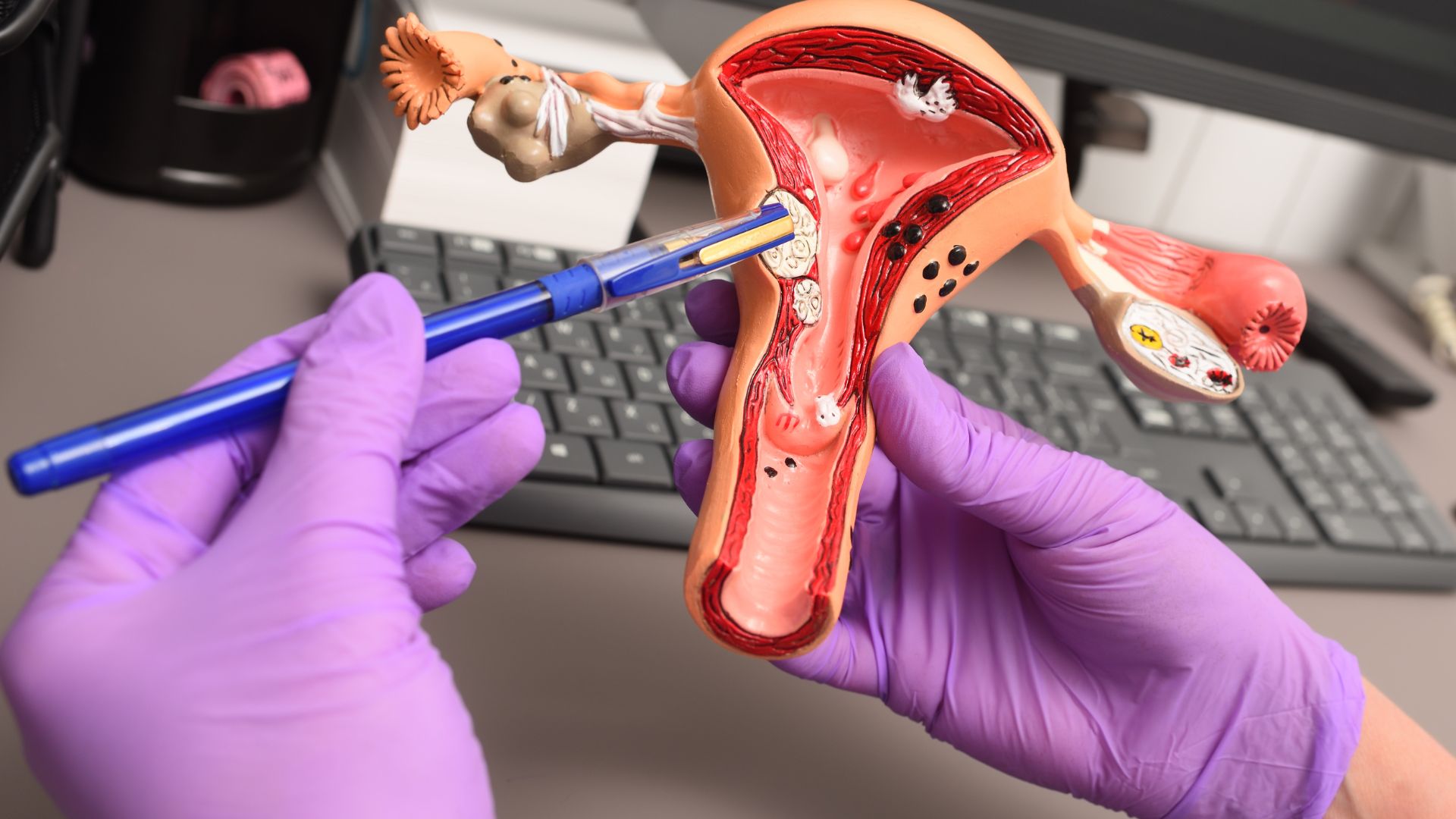 Une modélisation 3D d'utérus entre des mains gantées © Kalinovskiy de la part de Getty Images via Canva